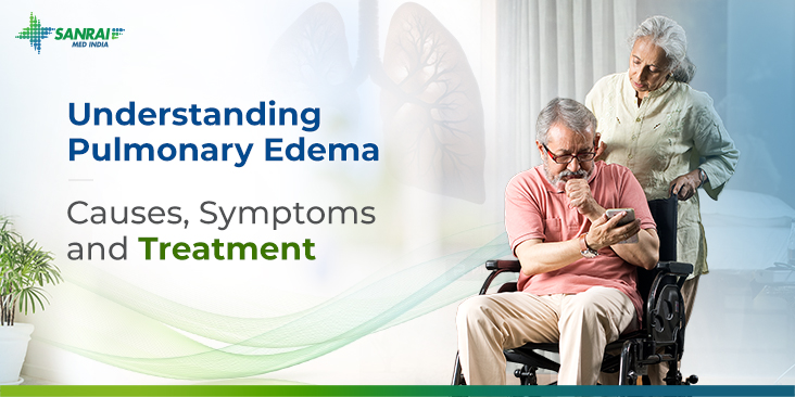 Understanding Pulmonary Edema Causes, Symptoms and Treatment